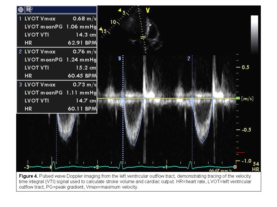 Use of the Echocardiogram to Define the Presence, Extent, and Etiology of Cardiac Dysfunction