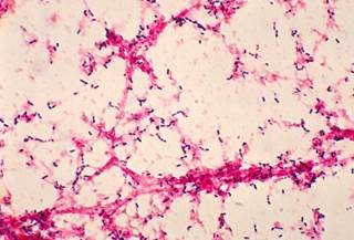 Early time to positivity of blood culture in pneumonia puts patients at higher risk for longer hospital stays and in-hospital mortality. Early time to positivity of blood culture in pneumonia puts patients at higher risk for longer hospital stays and in-hospital mortality.
