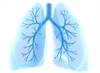 Improving Patient QoL With Atorvastatin in Bronchiectasis Improving Patient QoL With Atorvastatin in Bronchiectasis