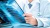 Case: Severe Acute Respiratory Distress Syndrome Following HCTZ Administration Case: Severe Acute Respiratory Distress Syndrome Following HCTZ Administration
