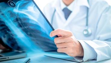 Case: Severe Acute Respiratory Distress Syndrome Following HCTZ Administration Case: Severe Acute Respiratory Distress Syndrome Following HCTZ Administration