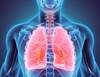 Morbidity, Mortality in VZV-Related Community-Acquired Pneumonia Morbidity, Mortality in VZV-Related Community-Acquired Pneumonia