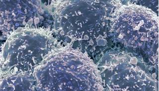 Radiotherapy is critical for effective lung cancer treatment, though when used with chemotherapy serious adverse events can occur. Radiotherapy is critical for effective lung cancer treatment, though when used with chemotherapy serious adverse events can occur.