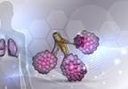 Triple Combo Regimens May Address Cause of Cystic Fibrosis Triple Combo Regimens May Address Cause of Cystic Fibrosis