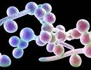 FDA: Fast Track Designation of VT-1598 for Valley Fever FDA: Fast Track Designation of VT-1598 for Valley Fever