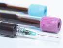 Does Procalcitonin Testing in COPD Impact Antibiotic Rx? Does Procalcitonin Testing in COPD Impact Antibiotic Rx?