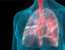 Interstitial Lung Disease Diagnosis Improved Using Rheumatologic Assessment Interstitial Lung Disease Diagnosis Improved Using Rheumatologic Assessment