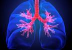 6MWT Clinically Relevant and Appropriate Prognostic Tool for PAH 6MWT Clinically Relevant and Appropriate Prognostic Tool for PAH