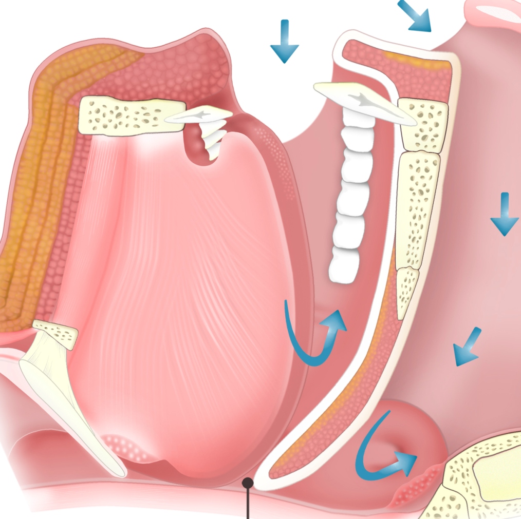 high-risk-obstructive-sleep-apnea-linked-to-longer-hospitalizations