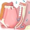 CTEPH Increases Risk for Sleep Disordered Breathing CTEPH Increases Risk for Sleep Disordered Breathing