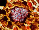 Disparities Remain in Prevalence of Cancer Screening Tests Disparities Remain in Prevalence of Cancer Screening Tests