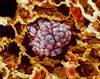 Non-small Cell Lung Cancer Survival Improved With Adoptive Cellular Immunotherapy Non-small Cell Lung Cancer Survival Improved With Adoptive Cellular Immunotherapy