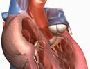 Poorer Right Atrial Function Predicts Worse Prognosis in Pulmonary Arterial Hypertension Poorer Right Atrial Function Predicts Worse Prognosis in Pulmonary Arterial Hypertension