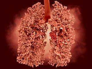 All-cause mortality was significantly lower in patients with grade 2 or higher immune-related adverse events. All-cause mortality was significantly lower in patients with grade 2 or higher immune-related adverse events.