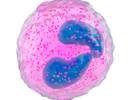Targeting Blood Eosinophil Counts in COPD Treatment Targeting Blood Eosinophil Counts in COPD Treatment