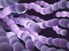 Characteristics of Bacterial Isolates Before and After PCV13 Introduction Characteristics of Bacterial Isolates Before and After PCV13 Introduction