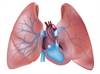 Pulmonary Hypertension Linked With Worse Prognosis in CKD, ESRD Pulmonary Hypertension Linked With Worse Prognosis in CKD, ESRD