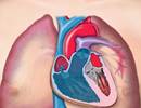 Thoracic and Pulmonary Conditions Associated With Connective Tissue Disease Thoracic and Pulmonary Conditions Associated With Connective Tissue Disease