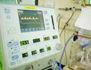 60-Day Mortality Not Significantly Lower With ECMO in ARDS 60-Day Mortality Not Significantly Lower With ECMO in ARDS