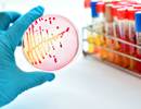Use of Antibiotic Prophylaxis in Young Children With Cystic Fibrosis Use of Antibiotic Prophylaxis in Young Children With Cystic Fibrosis