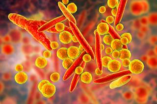 PCR was utilized to detect viruses, atypical bacteria, and other micro-organisms. PCR was utilized to detect viruses, atypical bacteria, and other micro-organisms.