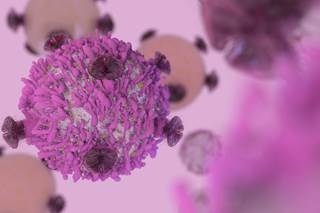 Lung cancer incidence and mortality were reduced with interleukin-1β inhibition. Lung cancer incidence and mortality were reduced with interleukin-1β inhibition.