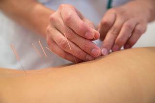 Meta-analysis results suggest that acupuncture is beneficial in treating cancer-related fatigue. Meta-analysis results suggest that acupuncture is beneficial in treating cancer-related fatigue.