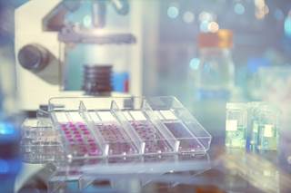 Circulating tumor cells are retained at the filter surface, leading to cell identification using classical morphological assessment of malignant cells. Circulating tumor cells are retained at the filter surface, leading to cell identification using classical morphological assessment of malignant cells.