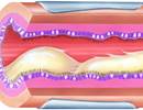 CFTR Modulator Therapy With Tezacaftor-Ivacaftor in Cystic Fibrosis CFTR Modulator Therapy With Tezacaftor-Ivacaftor in Cystic Fibrosis