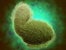 Bronchiolitis Treatment in Infants Varies by Hospital Bronchiolitis Treatment in Infants Varies by Hospital