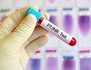 Anticoagulation Therapy Often Poorly Managed in Pulmonary Arterial Hypertension Anticoagulation Therapy Often Poorly Managed in Pulmonary Arterial Hypertension