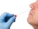 Influenza Testing Accuracy With Different Intranasal Specimen Collection Methods Influenza Testing Accuracy With Different Intranasal Specimen Collection Methods