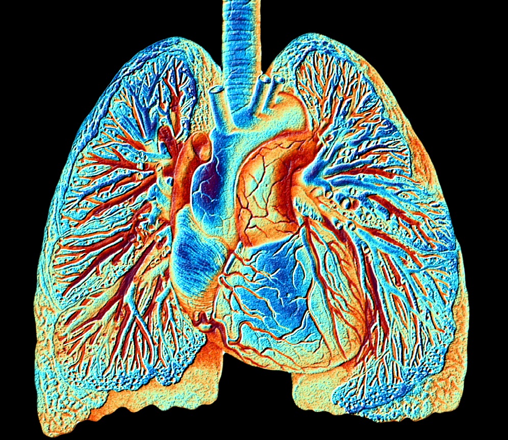 cardiopulmonary-exercise-testing-may-be-supplemented-by-preop-accelerometry