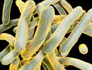 Tuberculosis Screening: Updated Recommendations from CHEST Tuberculosis Screening: Updated Recommendations from CHEST