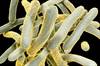 Tuberculosis Screening: Updated Recommendations from CHEST Tuberculosis Screening: Updated Recommendations from CHEST