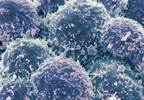 Periodontitis May Increase Cancer Risk Periodontitis May Increase Cancer Risk