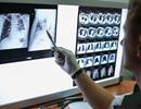 3D Super Clusters in COPD Could Affect Adjacent Healthy Tissue 3D Super Clusters in COPD Could Affect Adjacent Healthy Tissue