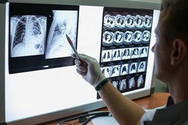 Prevalence and Predictors of Pain in COPD Prevalence and Predictors of Pain in COPD
