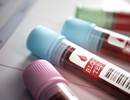 Procalcitonin-Guided Pneumonia Treatment Associated With Improved Outcomes Procalcitonin-Guided Pneumonia Treatment Associated With Improved Outcomes