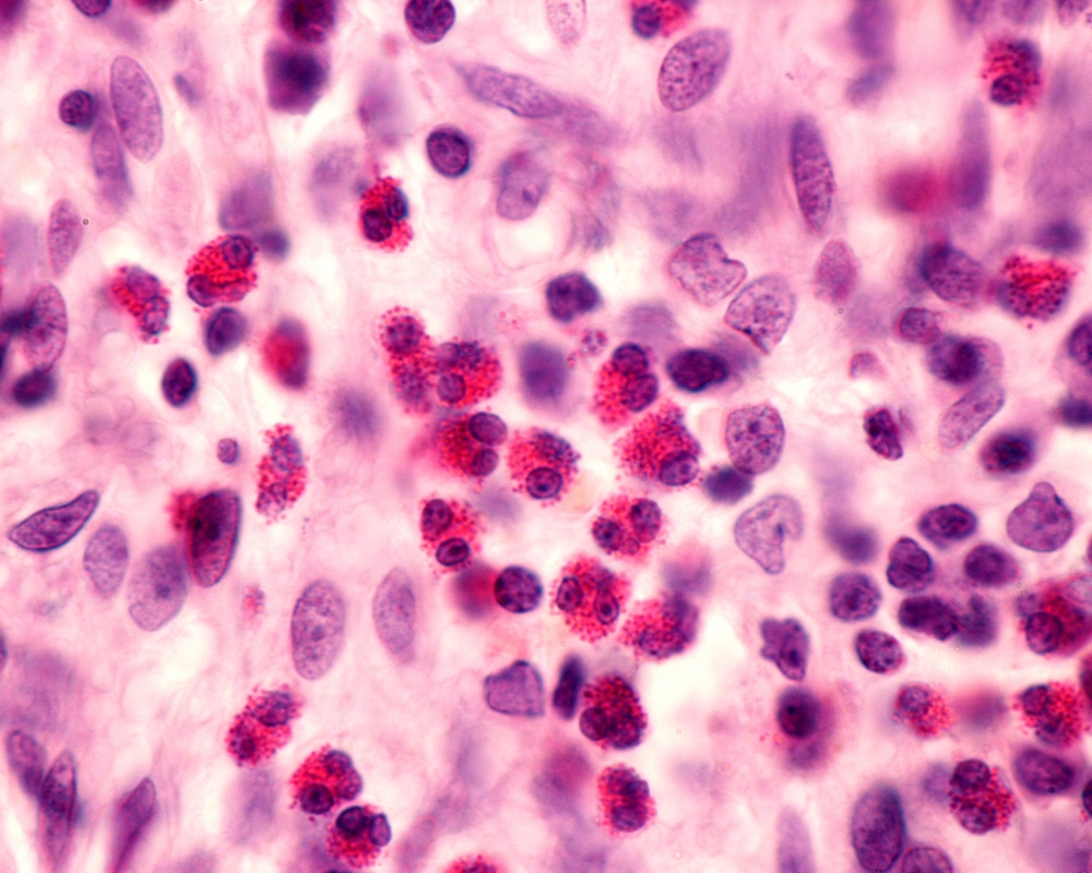 eosinophils blood test percentage