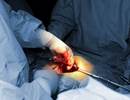 Reducing Postoperative Respiratory Complications Through Physiotherapy Reducing Postoperative Respiratory Complications Through Physiotherapy