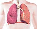 Guiding COPD Management Using Airway Branch Variation Guiding COPD Management Using Airway Branch Variation