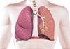 Guiding COPD Management Using Airway Branch Variation Guiding COPD Management Using Airway Branch Variation