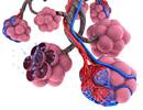 Hypoxemia in Idiopathic Pulmonary Arterial Hypertension Linked to Increased Mortality Hypoxemia in Idiopathic Pulmonary Arterial Hypertension Linked to Increased Mortality