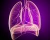 Idiopathic Pulmonary Arterial Hypertension and Risk for Cardiac Events Idiopathic Pulmonary Arterial Hypertension and Risk for Cardiac Events