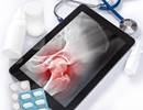 Glucocorticoids Do Not Increase Fracture Risk in COPD Glucocorticoids Do Not Increase Fracture Risk in COPD