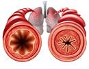Lung Function in Asthma Improves With Add-On Tiotropium Lung Function in Asthma Improves With Add-On Tiotropium