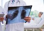 Comparing Diagnostic Imaging for Community-Acquired Pneumonia Comparing Diagnostic Imaging for Community-Acquired Pneumonia
