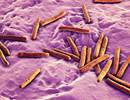 Elevated Tuberculosis Risk in Inhaled Corticosteroid Users Elevated Tuberculosis Risk in Inhaled Corticosteroid Users