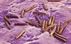 Effectiveness of Daily vs Thrice-Weekly Tuberculosis Regimens in HIV Patients Effectiveness of Daily vs Thrice-Weekly Tuberculosis Regimens in HIV Patients